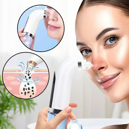 aspirateur point noir